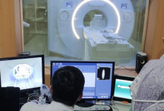 Peran Vital CT Scan dan MRI dalam Diagnosis Aneurisma Otak