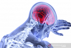 Stroke dan Aneurisma Tak Lagi Menakutkan, DSA Solusi Akurat dan Cepat