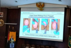 Perhatian pada Potensi Disfungsi Panggul Pascapersalinan Penting untuk Perempuan