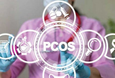 Memahami Gejala Sindrom Ovarium Polikistik (PCOS)